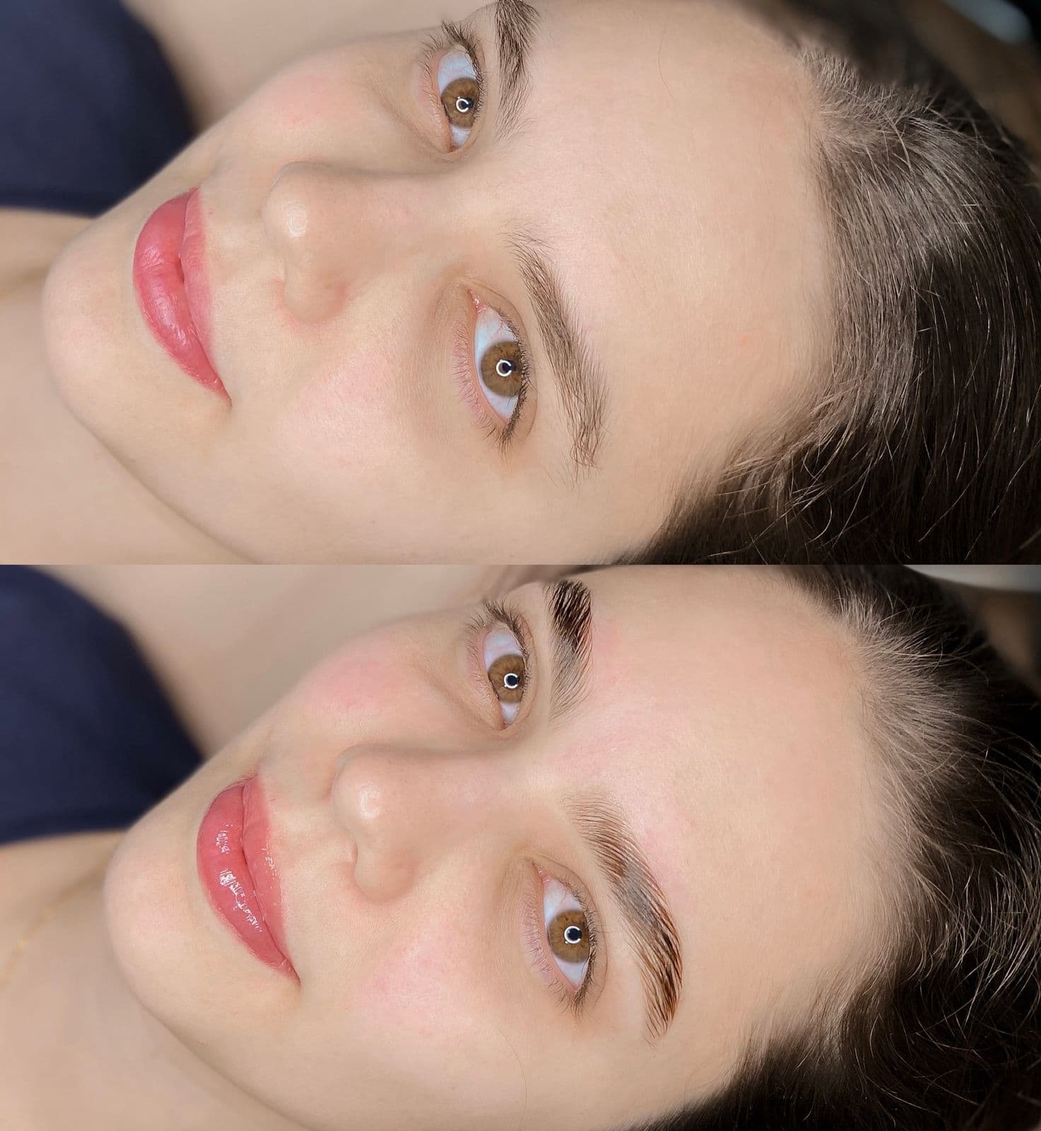 Tratamentos Faciais