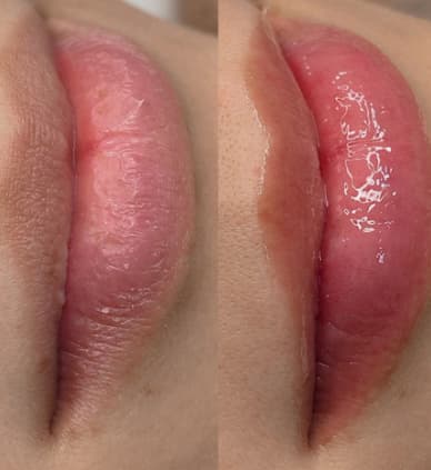 Hydra Gloss Lips